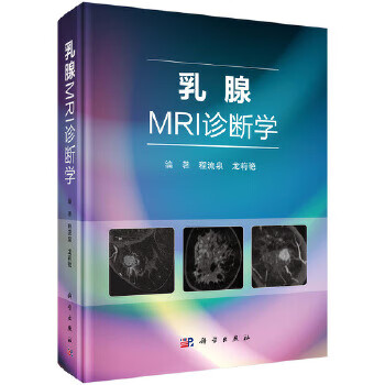 乳腺MRI診斷學 乳腺MRI診斷學