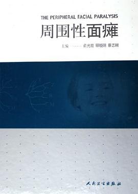 周圍性面癱