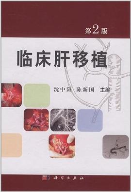臨床肝移植 臨床肝移植