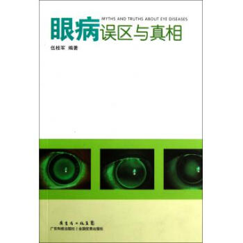 眼病誤區與真相 眼病誤區與真相
